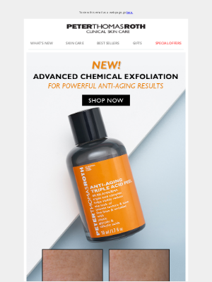 Peter Thomas Roth - JUST IN: Anti-Aging Triple Acid Peel