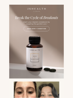 JS Health Vitamins - Break the Cycle of Breakouts