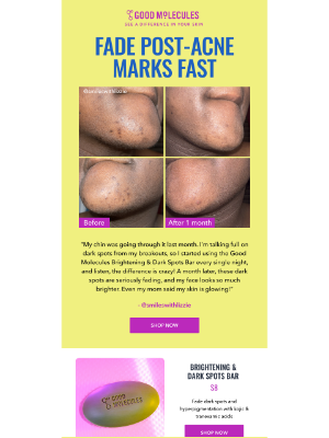 Good Molecules (Canada) - open for kojic acid bar results 💌