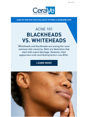 Acne 101: Blackheads vs Whiteheads