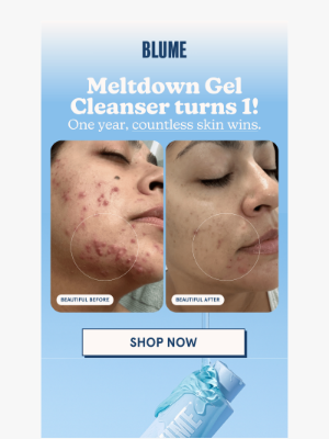Meet Blume - 1 year of skin wins 🎂