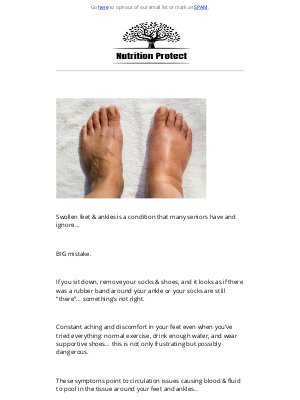 Perfect Keto - How are you dealing with, Swollen feet & ankles