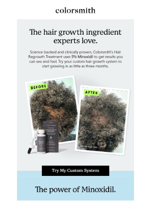 Colorsmith - Minoxidil—proven to get real results. 💯